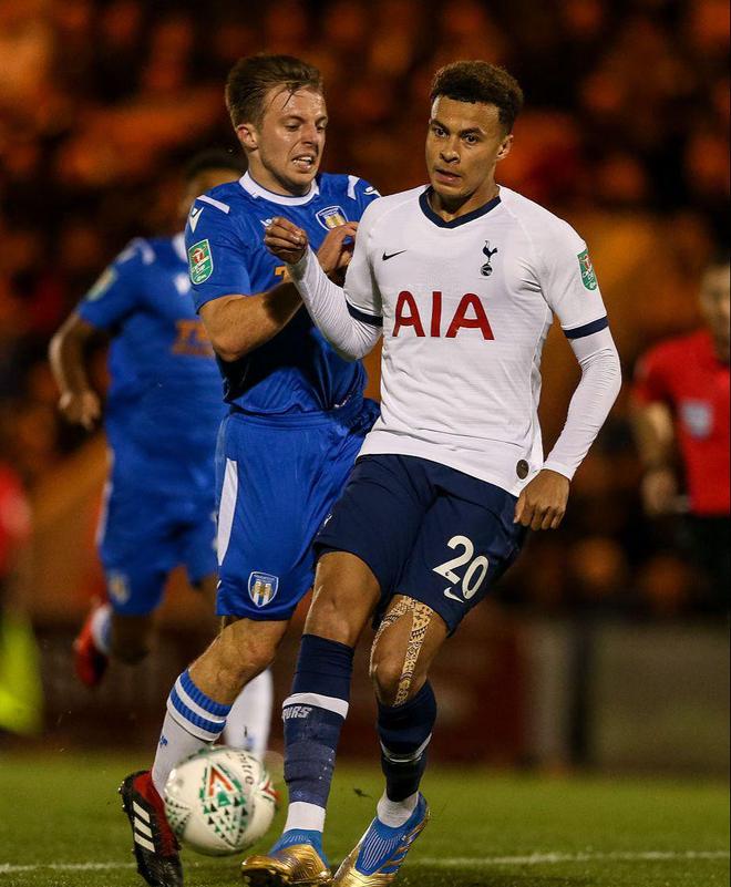 2-0！开场破门+补时补刀 核心+中卫双双伤退 13.1亿豪门17场不败（2-0！开场闪击+补时锁定胜局 核心与中卫双伤退，13.1亿豪门17场不败）